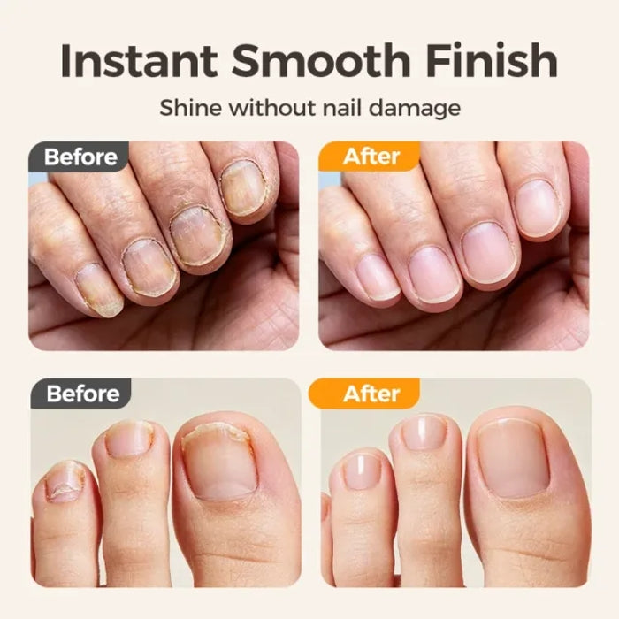 2-in-1 Smart Electric Nail Trimmer & Polisher for All Ages