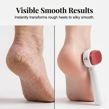 🦶 Double Sided Stainless Steel Foot Scraper Callus Remover ✨